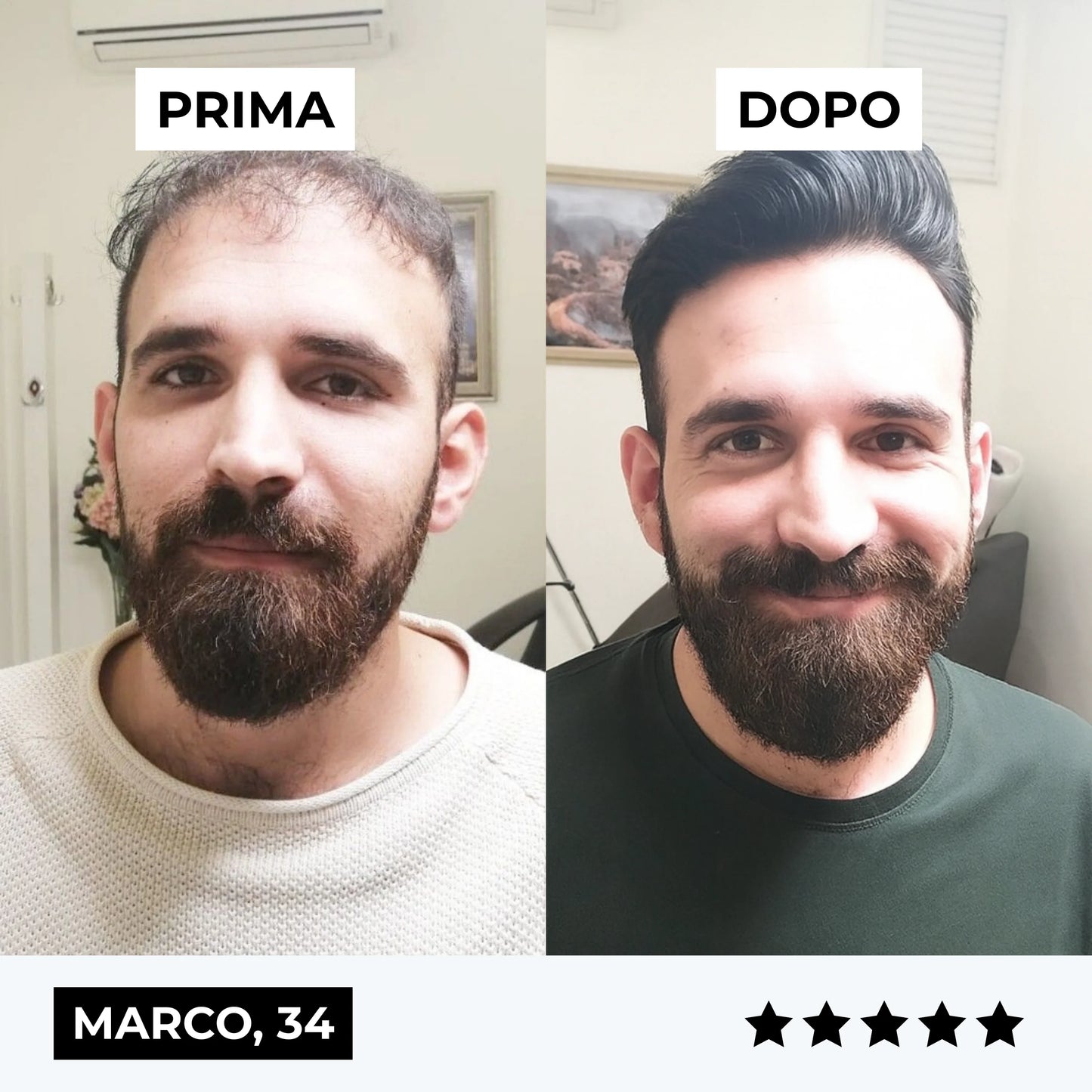 CURENSE - Sistema di micro-infusione per la ricrescita dei capelli