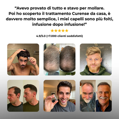 CURENSE - Sistema di micro-infusione per la ricrescita dei capelli